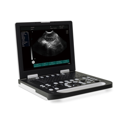 Sistema a ultrasuoni Full Digital Laptop