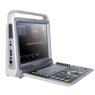 Ecografia Doppler portatile a colori