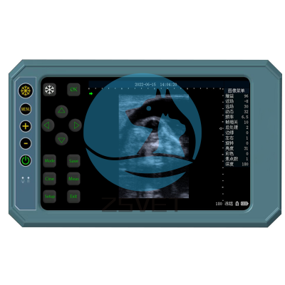 Scanner a ultrasuoni digitali completi
